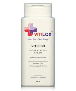 Vitiligo Vitilox Pigmentation Cream