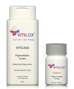 Vitiligo Vitilox Pigmentation Cream & Vitilox T-Cell-V Immune Therapy
